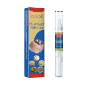 removal cream for skin tags