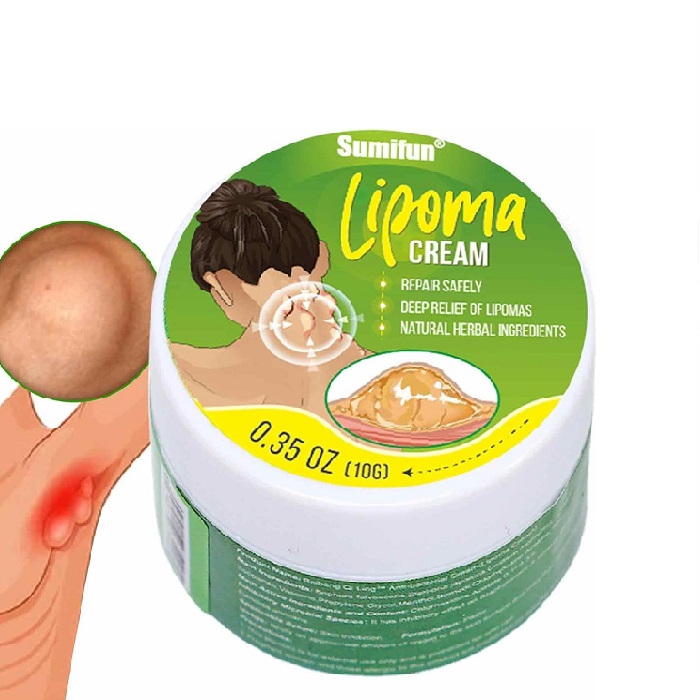 Lipomas treatment cream