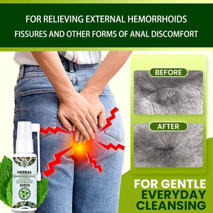 herbal hemorrhoid relief spray