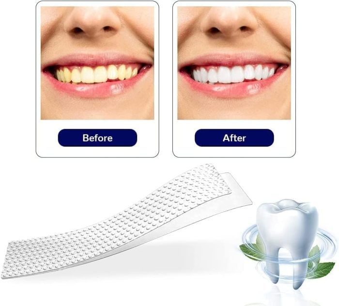 teeth whitening strips