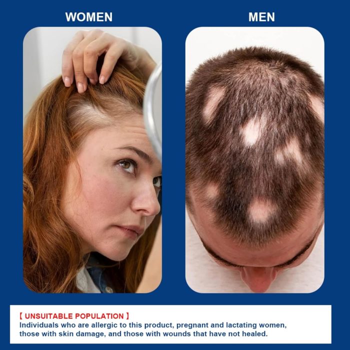 hair growth cream