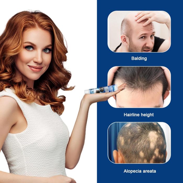hair growth cream